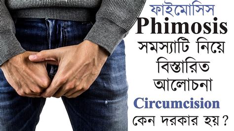 circumcision meaning in bengali|Circumcision .